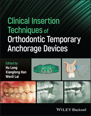 Clinical Insertion Techniques of Orthodontic Temporary Anchorage Devices - Orginal Pdf